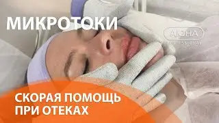 ОТЁКИ НА ЛИЦЕ. Микротоковая терапия как метод скорой помощи