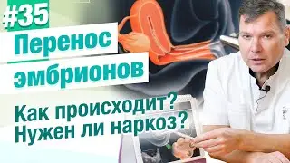 Перенос эмбрионов в матку. Как происходит? Нужен ли наркоз?