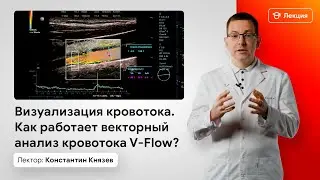 Визуализация кровотока. Как работает векторный анализ кровотока V-Flow?