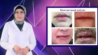Болезни губ у взрослых и детей: причины, симптомы и лечение