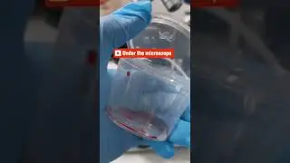 period blood under the microscope 