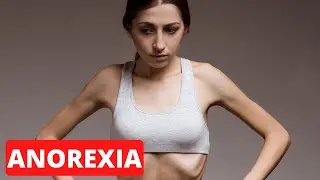 ANOREXIA explained: symptoms, causes, types, treatments, prevention