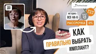 Как правильно выбрать импланты?⭐️+7 (495) 255-59-37 😍Алла, 61 год. Видеоотзыв.