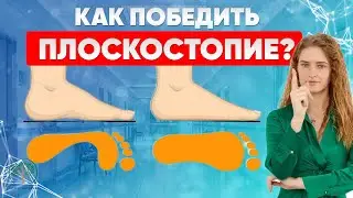 УЗНАЙТЕ ПРАВДУ: плоскостопие вызывает артроз, недержание мочи, варикоз. Что делать?