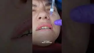 Что такое гранулы фарадайса