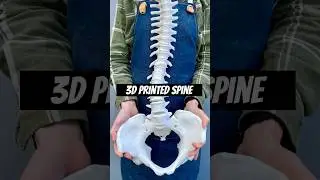 3D printing bones  #3dprinting