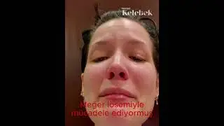 Şarkıcı Halsey sosyal medyadan duyurdu... Meğer sessizce lösemiye karşı savaş veriyormuş!