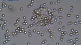 Bread Mold Under Microscope