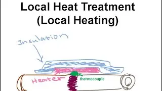 What is Local Heat Treatment?