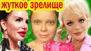 ИХ НЕ УЗНАТЬ! - Вот Что Пластика СДЕЛАЛА СО ЗВЁЗДАМИ Отечественного Шоу-Бизнеса