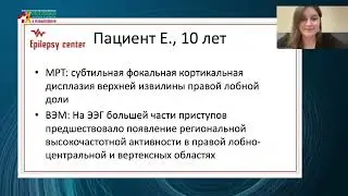 19.02.2022 Восстановление повреждённого мозга. Фармакорезистентная структурная эпилепсия