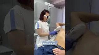 Лазерная эпиляция для мужчин😎 