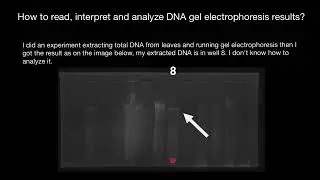 How to read, interpret and analyze DNA gel electrophoresis results?