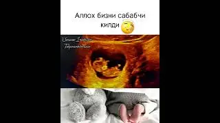 МАЛУМОТ УЧУН ФАКАТ ТЕЛЕГРАМДАН ЁЗИНГ: +998950014004 #Узи #беременность #гинекология #Хомиладорлик