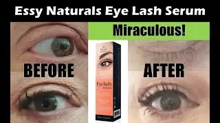ESSY NATURALS EYELASH SERUM | Miracles do happen! Thanks to this product I have long eyelashes!