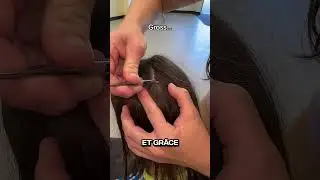 Elle Trouve Ca sur la Tête de sa Fille ! 😱