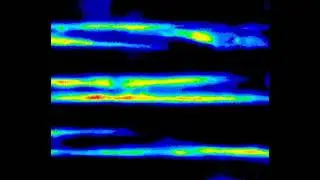 A Biomimetic Optical Cardiac Fibrosis-on-a-Chip for High-Throughput Anti-Fibrotic Drug Movie 2