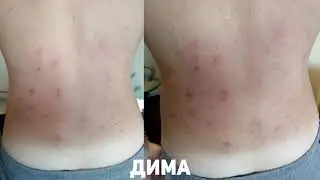 Лечебный режим. Что делать во время лечения болей в спине?