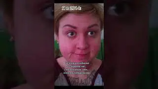 15 лет страдала от РПП  