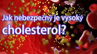 (CZ) Za Hranicemi Čísel: Pochopení Cholesterolu a Kroky ke Zdravějšímu Já!