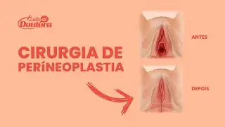 O QUE É A CIRURGIA DE PERÍNEOPLASTIA