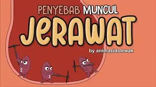 Kenapa Bisa Jerawatan? | Animasi Dolewak