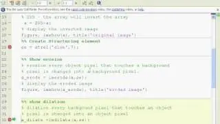 Matlab Morphology erode dilate open close strel tutorial
