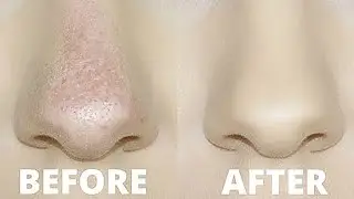 HOW TO STOP FOUNDATION RUBBING OFF YOUR NOSE! | OILY SKIN TRICKS!