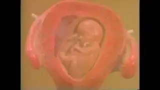 Безмолвный крик / The silent scream