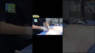 [300만]가슴성형 후 마사지 필요한 이유 