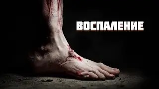 Воспаление // Патфизиология (3 тема)