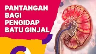 Cara Mengobat Batu Ginjal