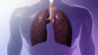 Black Lung