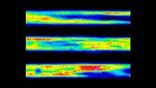 A Biomimetic Optical Cardiac Fibrosis-on-a-Chip for High-Throughput Anti-Fibrotic Drug Movie 1