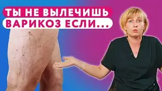 Как ВАРИКОЗ убивает! 