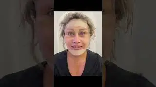 Как помолодеть на 20 лет? Пластическая операция - пластический хирург Татьяна Романовская