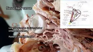 Orbit - dissection |  Parts | Relations | Applied Anatomy