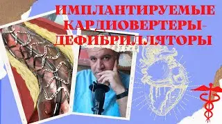 Имплантируемые кардиовертеры-дефибрилляторы (ИКД). Когда в груди скорая помощь!