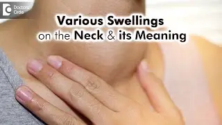 Neck Swelling that keeps on increasing and decreasing |Facts - Dr. Surekha Tiwari | Doctors' Circle