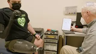UD grad pioneers bionic arm technology