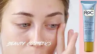 7 Days Dark Circles Removal Challenge | Permanent Treatment for Dark Circles