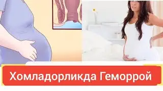 Хомладороикда геморрой белгилари ва даволаш.
