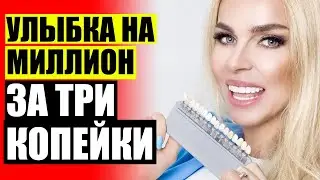 КАК СТАВЯТ ВИНИРЫ НА ПЕРЕДНИЕ ЗУБЫ 😬