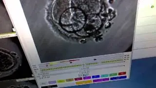 Primo-Vision & time lapse