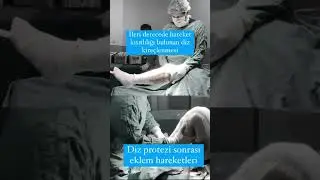Dizi Bükülmeyen Hastanın Diz Protezi Ameliyat Sonrası Eklem Hareketleri 