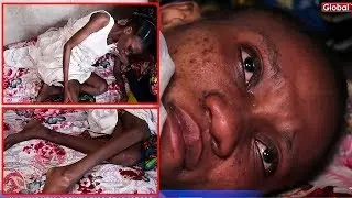 MUNGU WANGU! Binti Huyu ANATESEKA Sana, Miaka 6 KITANDANI, Tumsaidie!