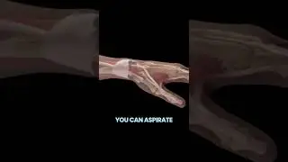 Bible Bump Cyst Popping - Would you do it? 