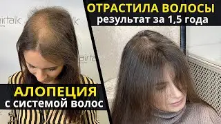 Отрастила свои волосы! 1,5 года с системой волос