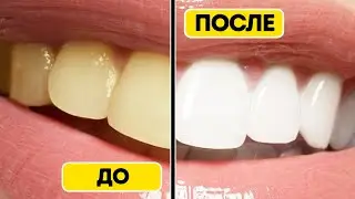 ЛУЧШИЙ способ отбеливания зубов в ДОМАШНИХ УСЛОВИЯХ без вреда для эмали