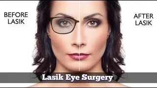 What is LASIK Eye Surgery? | How LASIK Eye Surgery Works | Explained